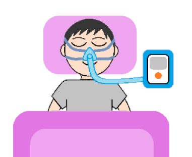 CPAP療法イメージ